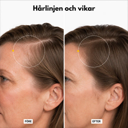 Hairzy - Väcker hårbotten. Frigör volymen.