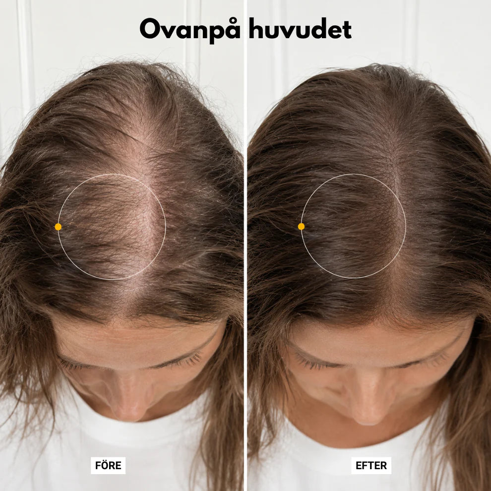 Hairzy - Väcker hårbotten. Frigör volymen.