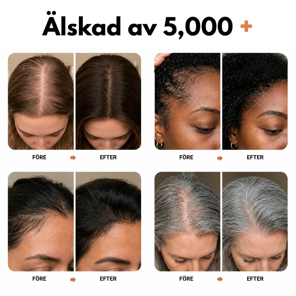 Hairzy - Väcker hårbotten. Frigör volymen.
